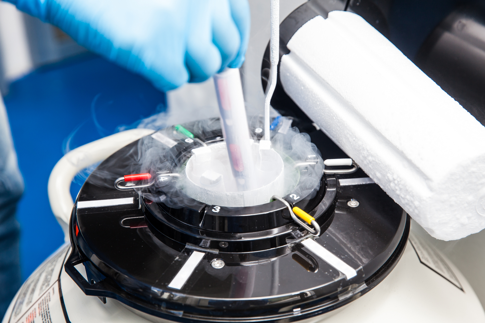 Egg Freezing